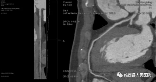 61c96cdc0b28c.png image.png