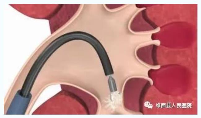 645dec1668aa9.jpg 1.jpg